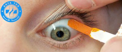 کاغذ فلورسین چیست؟ و پزشک ها چه زمانی از آن استفاده میکنند! (1)