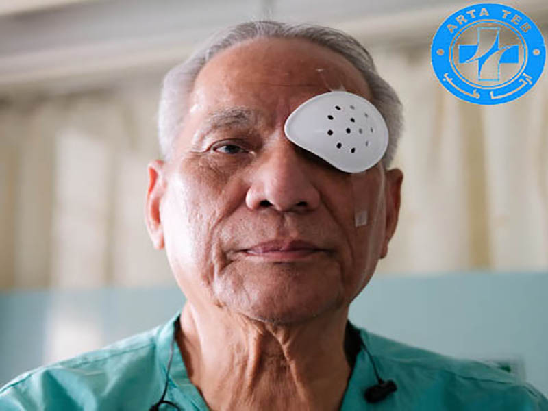 انواع شیلد چشمی پلاستیکی