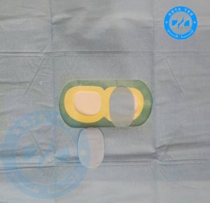 شان جراحی استرابیسم 2