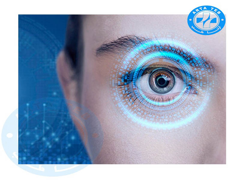 درمان تنبلی چشم با دستگاه CAM