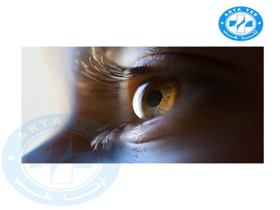 نظارت بر درمان تنبلی چشمدر CAM therapy