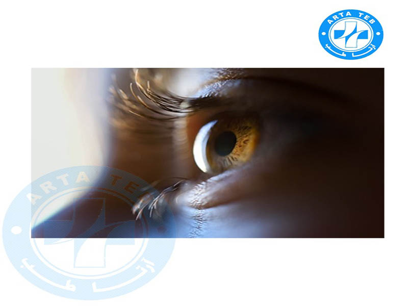 نظارت بر درمان تنبلی چشمدر CAM therapy