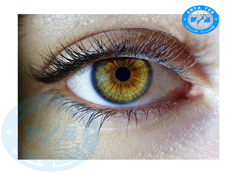 نحوه کار کردن دستگاه CAM