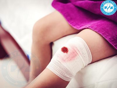 لانگ گاز طبی غیر استریل و استریل