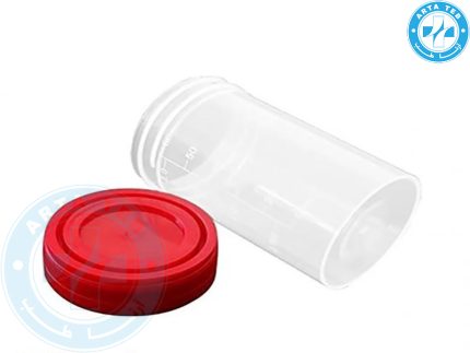 ظرف نمونه گیری ادرار 60میلیمتر شفاف سوپا